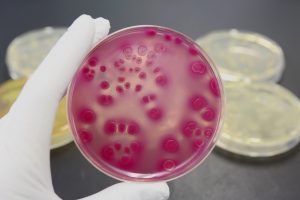 e. coli bestrijden h-ns eiwit